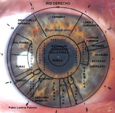 Mapa Del Iris Derecho Lateralidad De Los Signos Iridolog A Saludbio